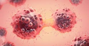 cancer specialist in Mumbai